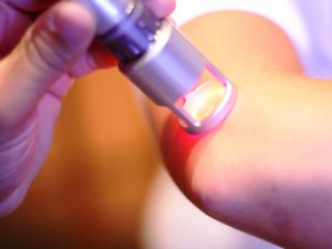elbow pain relief from laser therapy